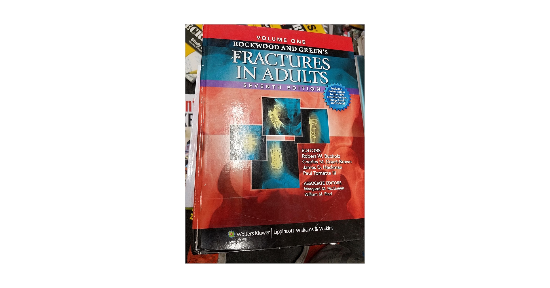 健康・医学 Rockwood and Green's Fractures in Adults Rockwood and Green's Fractures in Adults: Robert W. Bucholz